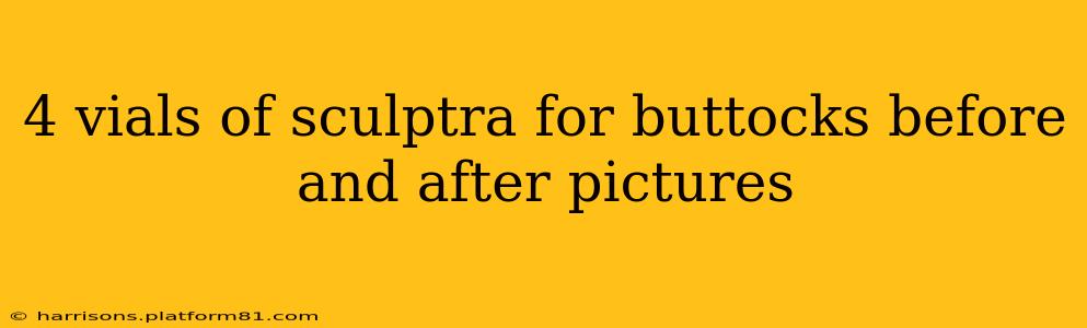 4 vials of sculptra for buttocks before and after pictures