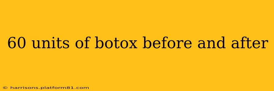 60 units of botox before and after