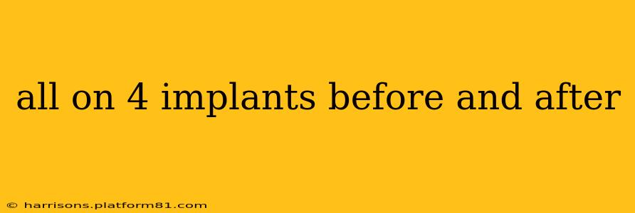 all on 4 implants before and after