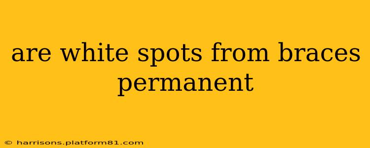 are white spots from braces permanent