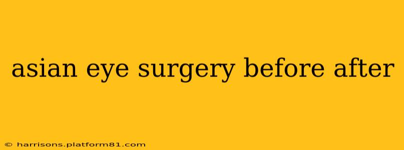 asian eye surgery before after