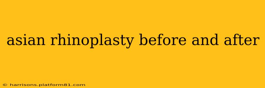 asian rhinoplasty before and after
