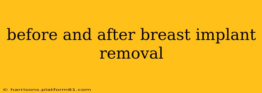 before and after breast implant removal
