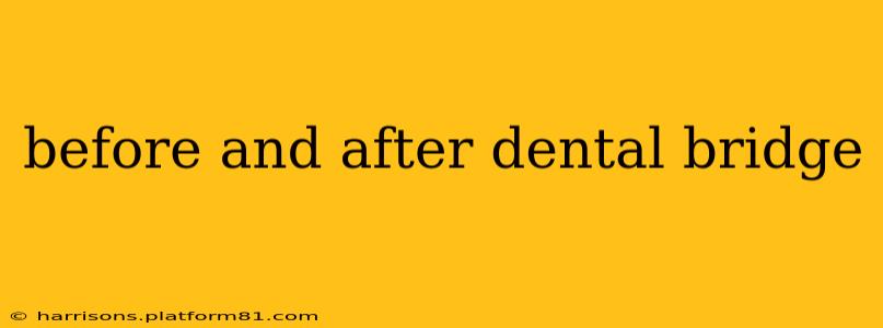 before and after dental bridge