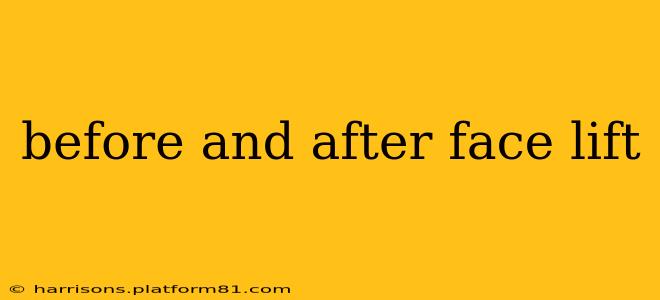 before and after face lift