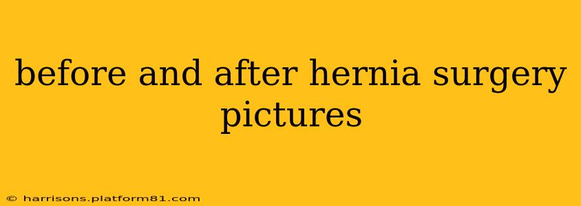 before and after hernia surgery pictures
