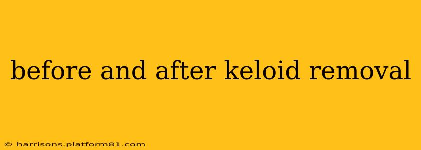 before and after keloid removal