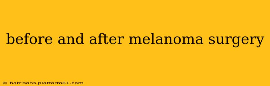 before and after melanoma surgery