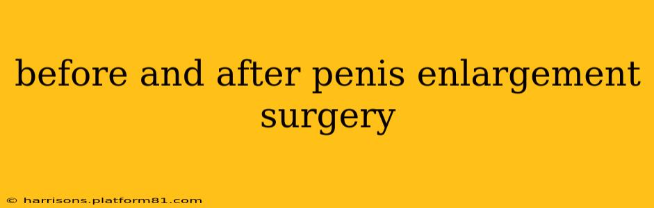 before and after penis enlargement surgery