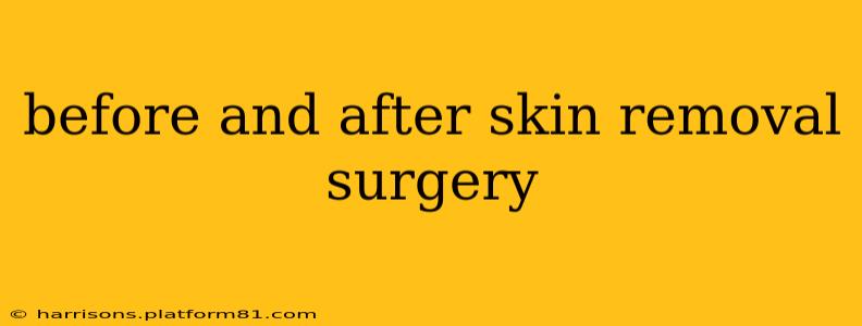 before and after skin removal surgery