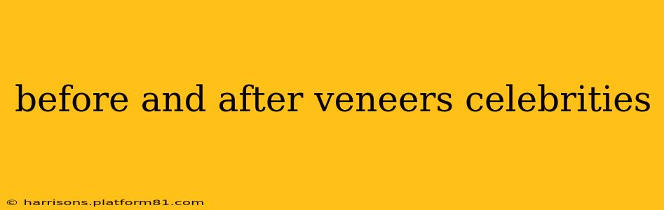 before and after veneers celebrities