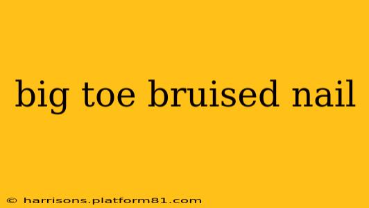 big toe bruised nail