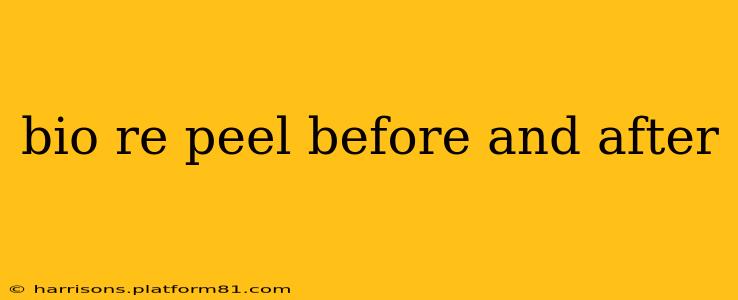 bio re peel before and after