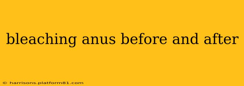 bleaching anus before and after