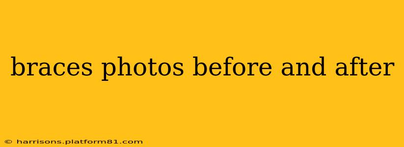braces photos before and after