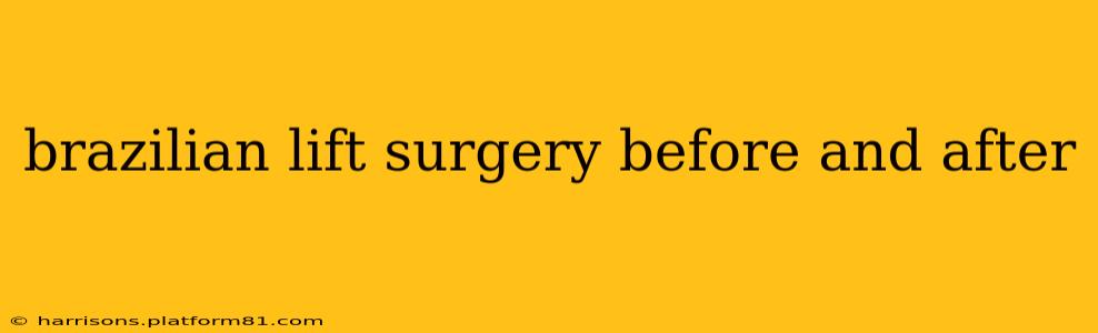 brazilian lift surgery before and after