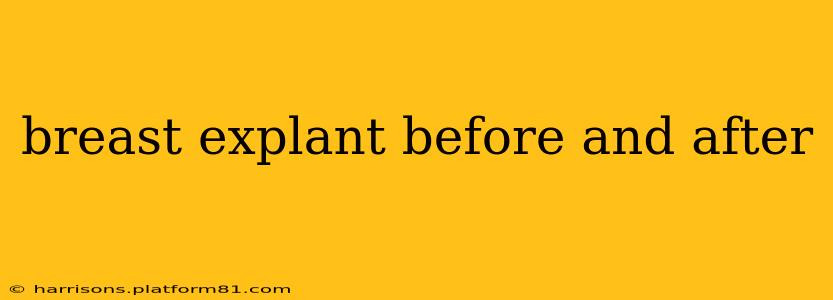 breast explant before and after