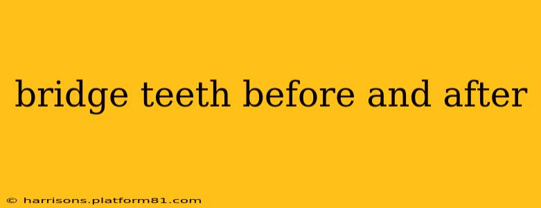bridge teeth before and after
