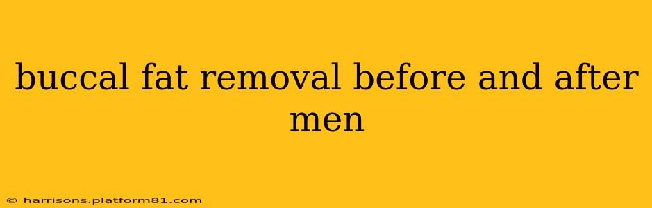 buccal fat removal before and after men