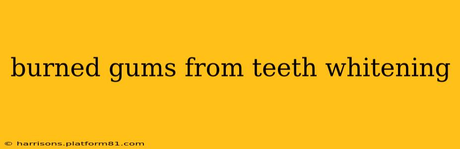 burned gums from teeth whitening