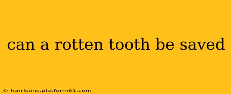 can a rotten tooth be saved