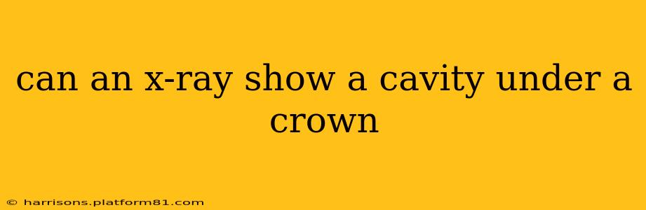 can an x-ray show a cavity under a crown