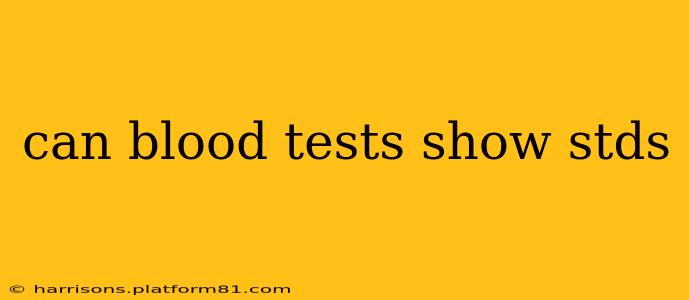 can blood tests show stds