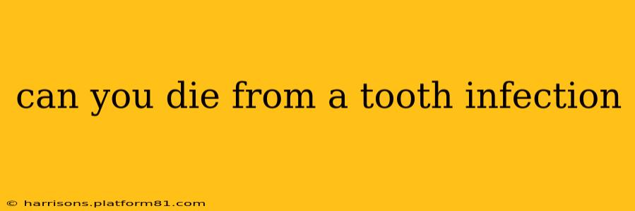 can you die from a tooth infection