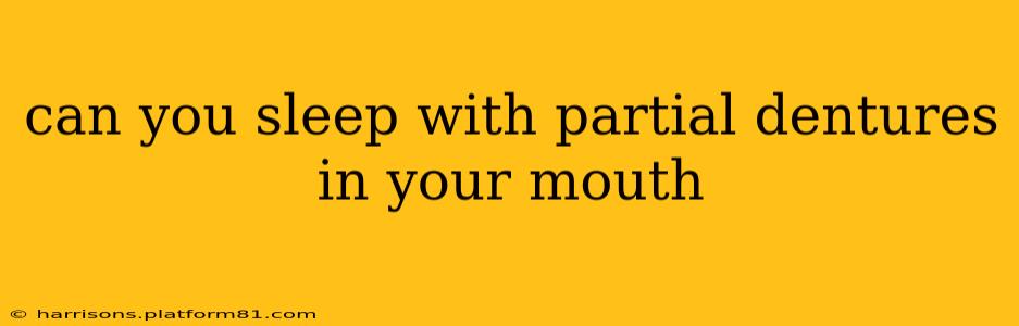 can you sleep with partial dentures in your mouth