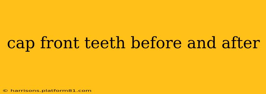 cap front teeth before and after