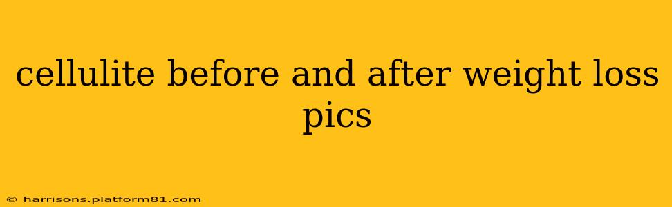 cellulite before and after weight loss pics
