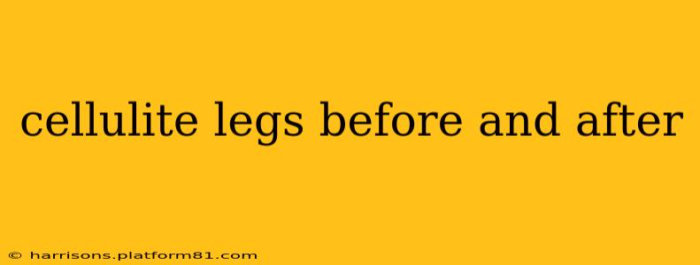 cellulite legs before and after