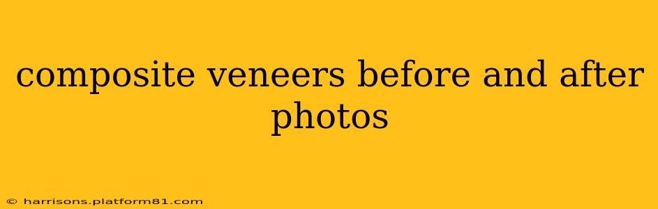 composite veneers before and after photos