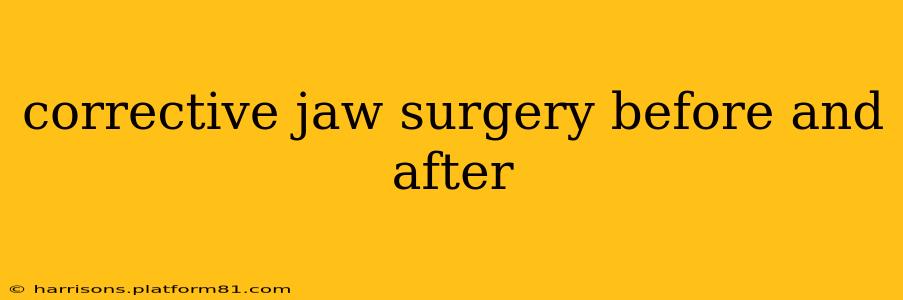 corrective jaw surgery before and after
