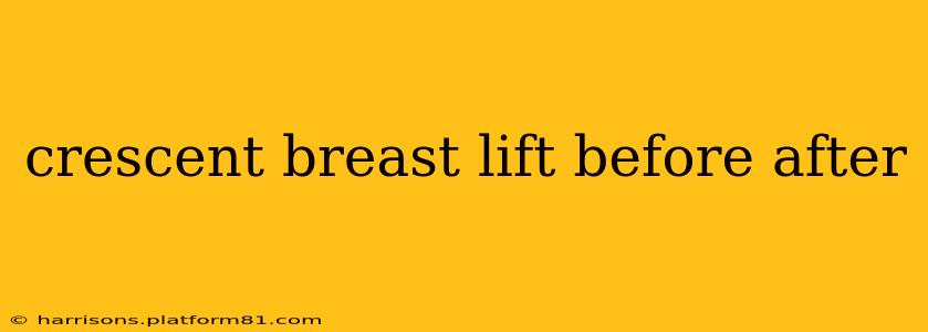 crescent breast lift before after