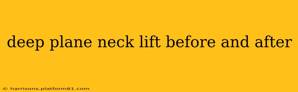 deep plane neck lift before and after