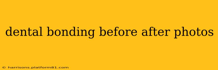 dental bonding before after photos