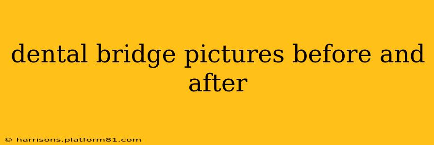dental bridge pictures before and after