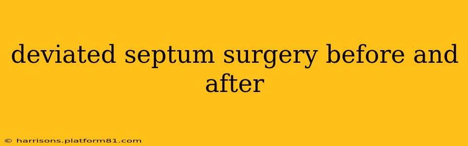 deviated septum surgery before and after