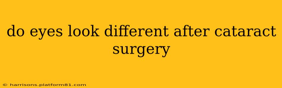 do eyes look different after cataract surgery