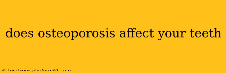 does osteoporosis affect your teeth