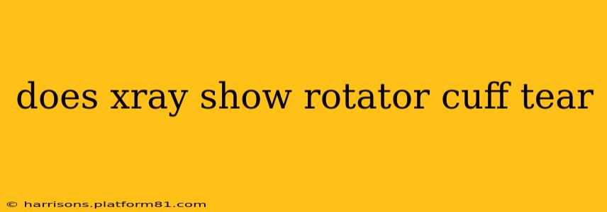 does xray show rotator cuff tear