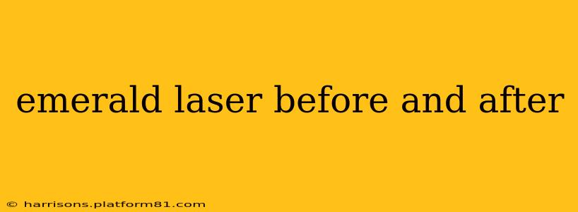 emerald laser before and after