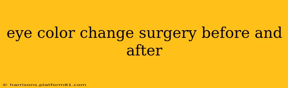 eye color change surgery before and after