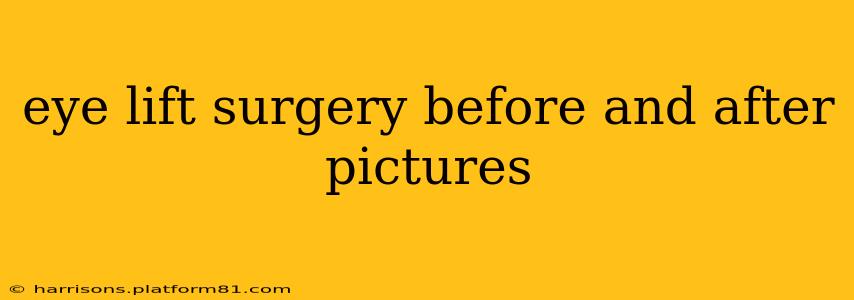 eye lift surgery before and after pictures