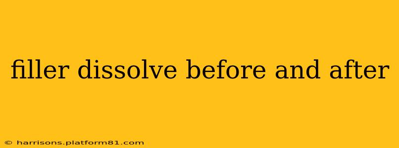 filler dissolve before and after