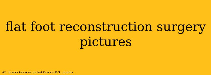 flat foot reconstruction surgery pictures