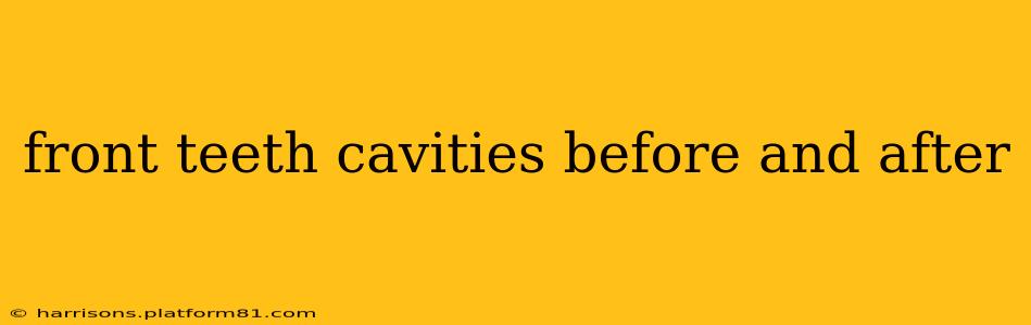 front teeth cavities before and after