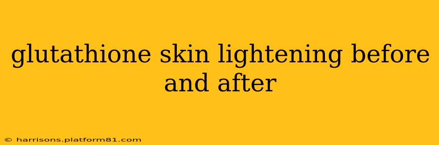 glutathione skin lightening before and after