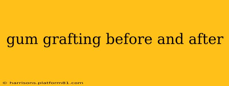gum grafting before and after